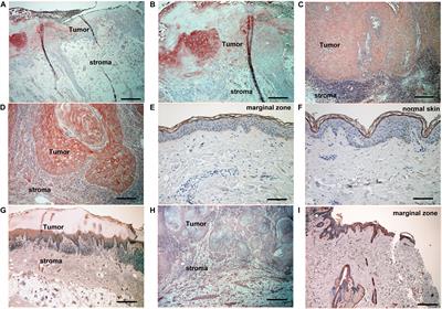 Possible Roles of Proinflammatory Signaling in Keratinocytes Through Aryl Hydrocarbon Receptor Ligands for the Development of Squamous Cell Carcinoma